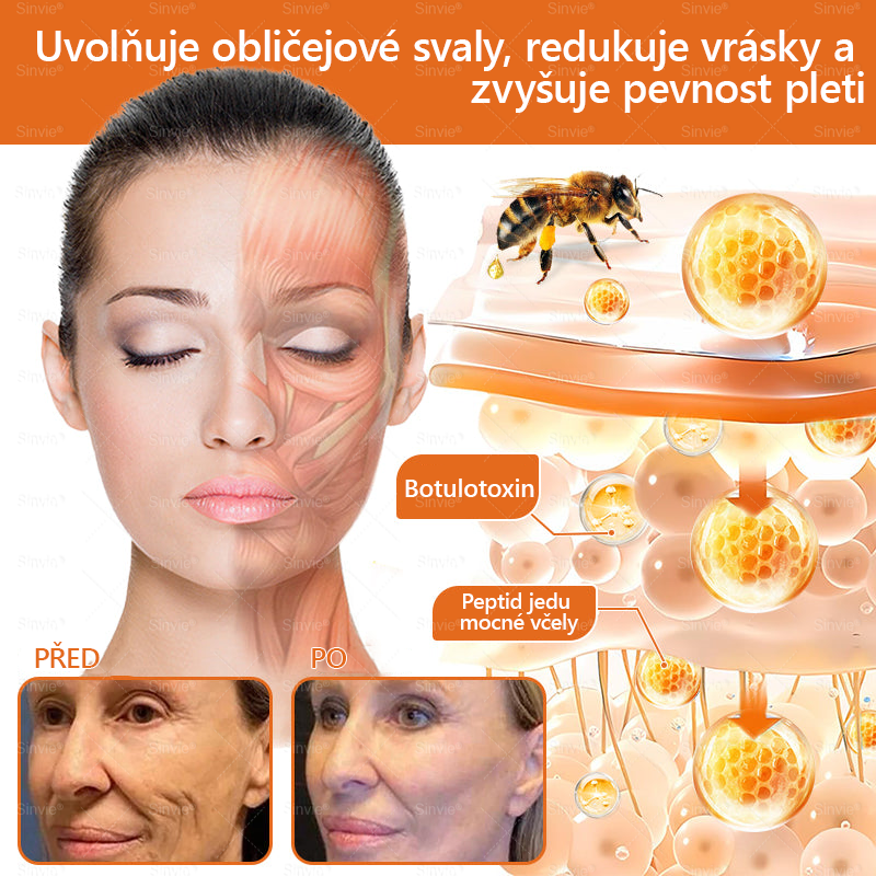 🎈Sinvie® Krém na obnovu pleti s včelím jedem | 50 ml | Doporučeno Českou dermatovenerologickou společností