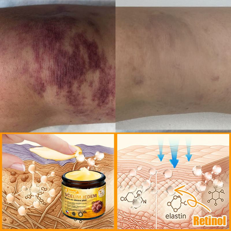 🎈Sinvie® Krém na obnovu pleti s včelím jedem | 50 ml | Doporučeno Českou dermatovenerologickou společností