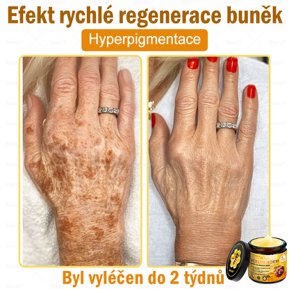 🎁 Zbývá pouze 5 boxů. Nabízíme vám extra 50% slevu! Udržujte si zdravou postavu. Pokud to teď propásnete, příští rok už nebude žádná šance.