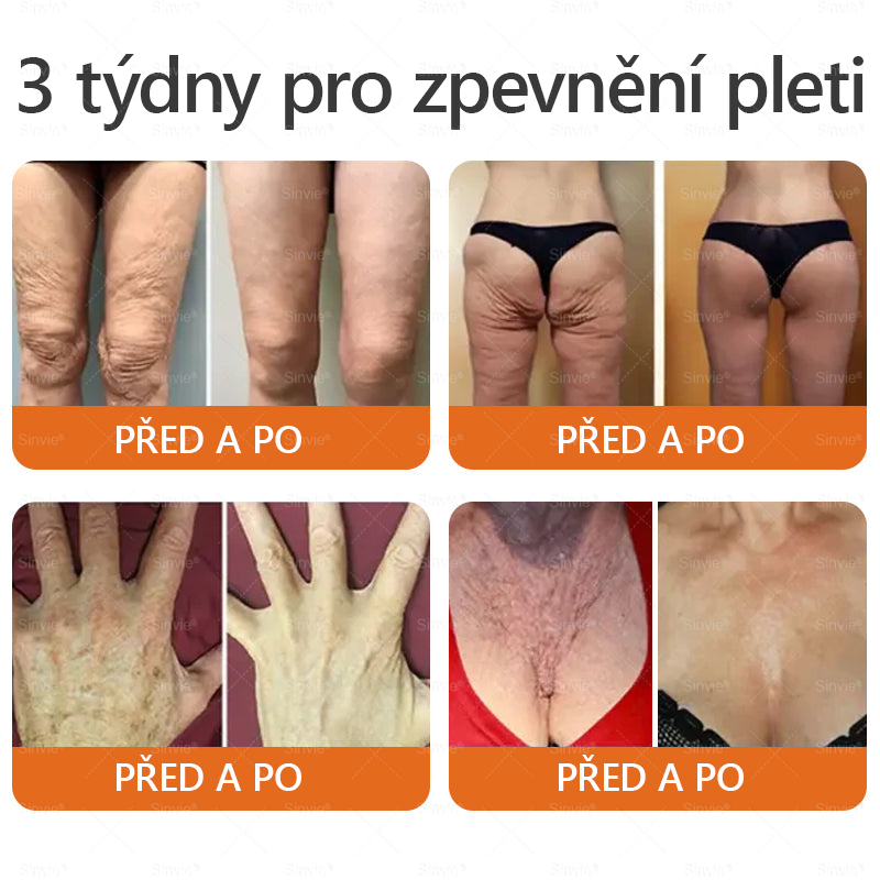 🎁 Zbývá pouze 5 boxů. Nabízíme vám extra 50% slevu! Udržujte si zdravou postavu. Pokud to teď propásnete, příští rok už nebude žádná šance.