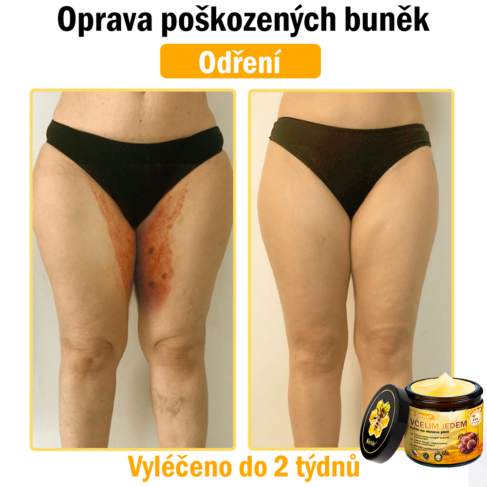 🎁 Zbývá pouze 5 boxů. Nabízíme vám extra 50% slevu! Udržujte si zdravou postavu. Pokud to teď propásnete, příští rok už nebude žádná šance.