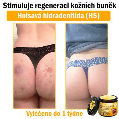 🎁 Zbývá pouze 5 boxů. Nabízíme vám extra 50% slevu! Udržujte si zdravou postavu. Pokud to teď propásnete, příští rok už nebude žádná šance.