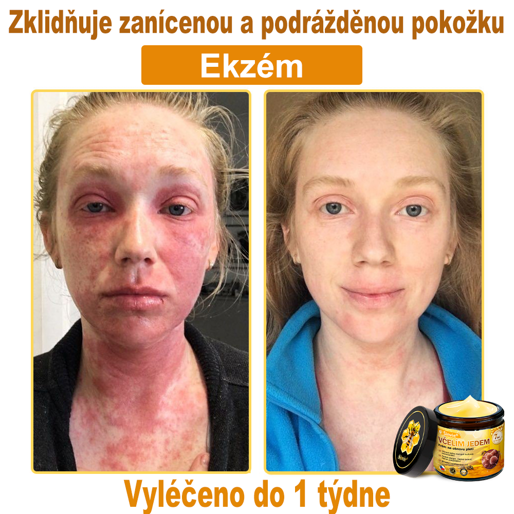 🎁 Zbývá pouze 5 boxů. Nabízíme vám extra 50% slevu! Udržujte si zdravou postavu. Pokud to teď propásnete, příští rok už nebude žádná šance.