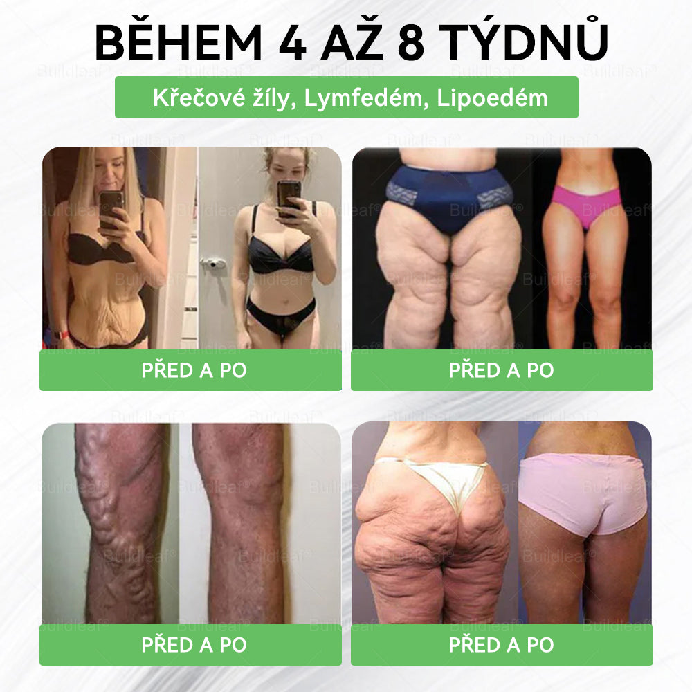 🏥Oficiální obchod ČR | BuildLeaf® GLP-1 8-v-1 Fit & Vital Řešení (Jednou denně, viditelné změny za 7 dní) ✅ Obezita, kardiovaskulární zdraví, cukrovka, spánková apnoe, zdraví střev, problémy se klouby a další.