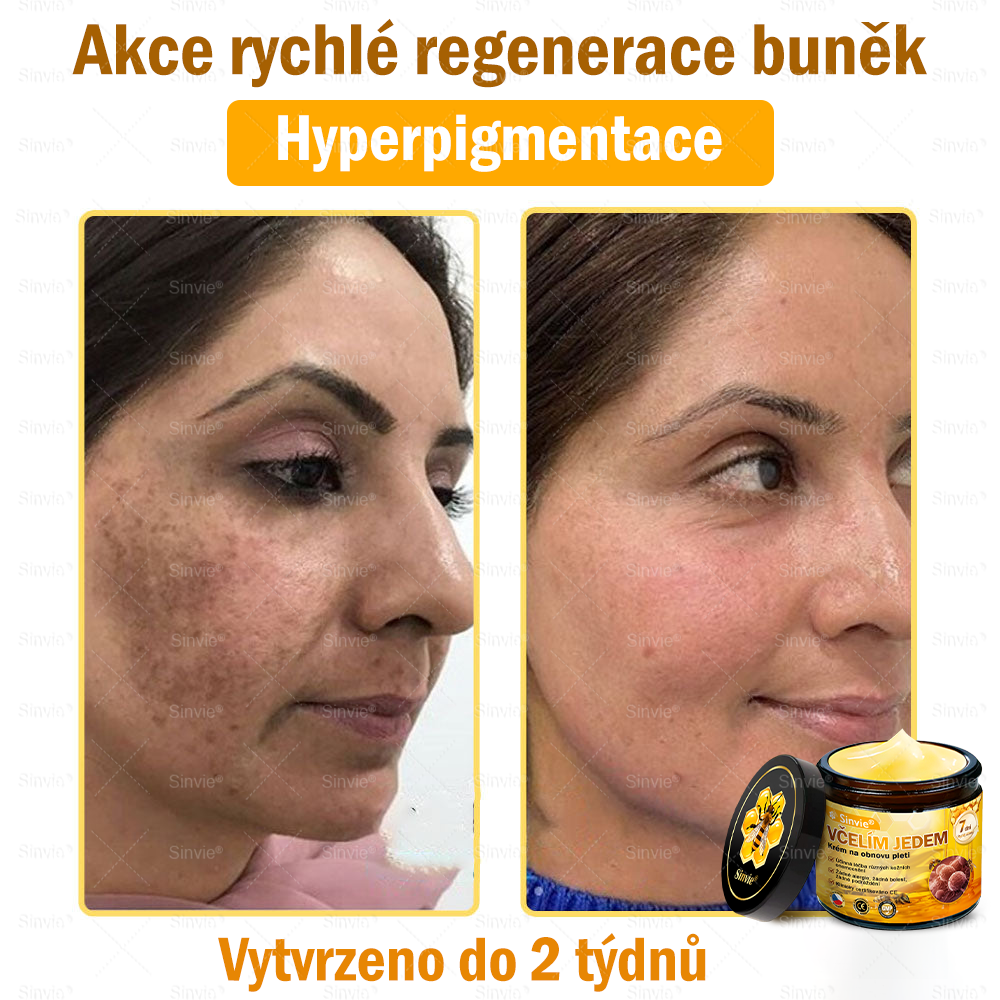 🎁 Zbývá pouze 5 boxů. Nabízíme vám extra 50% slevu! Udržujte si zdravou postavu. Pokud to teď propásnete, příští rok už nebude žádná šance.